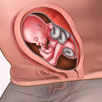 Week 22